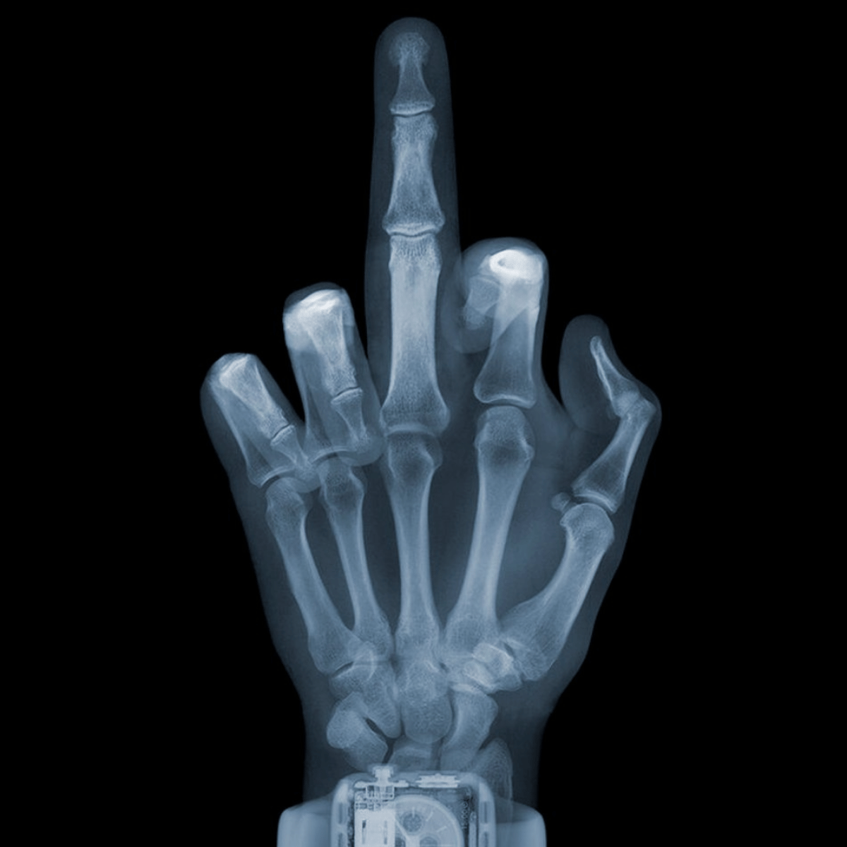 NICK VEASEY, Finger with Watch